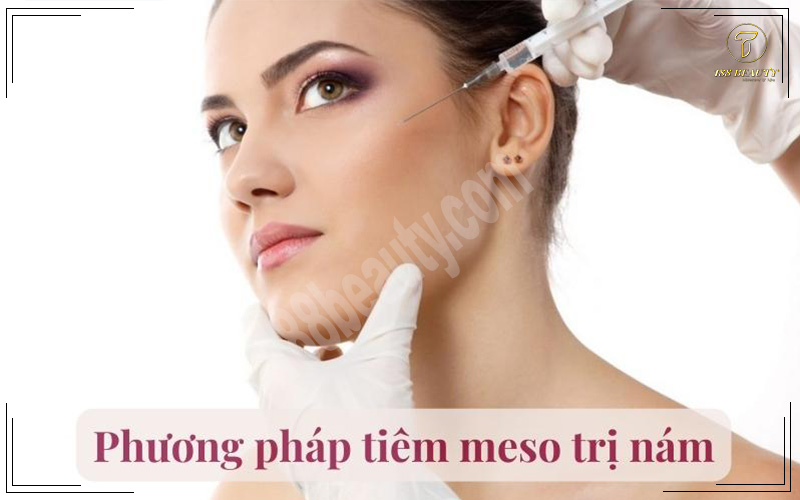 Tiêm meso trị nám