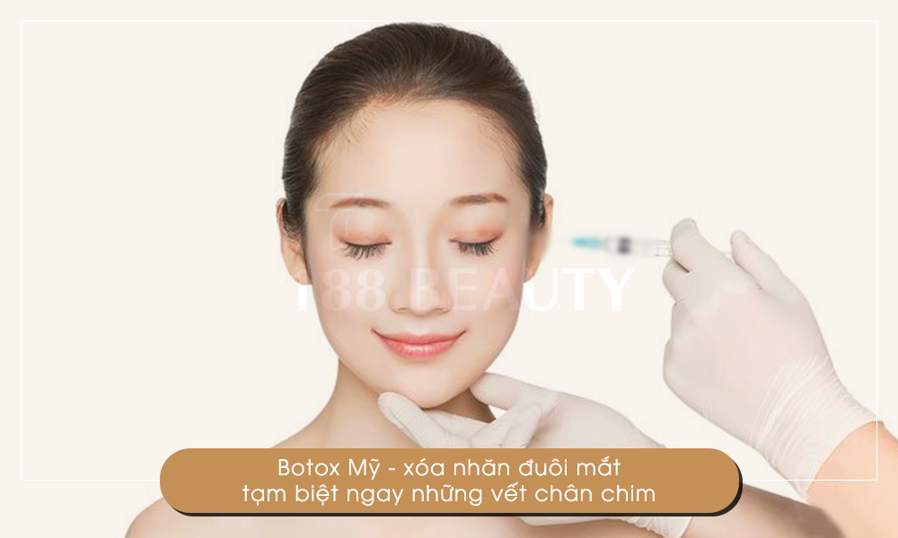 13-Botox-Mỹ-xóa-nhăn-đuôi-mắt