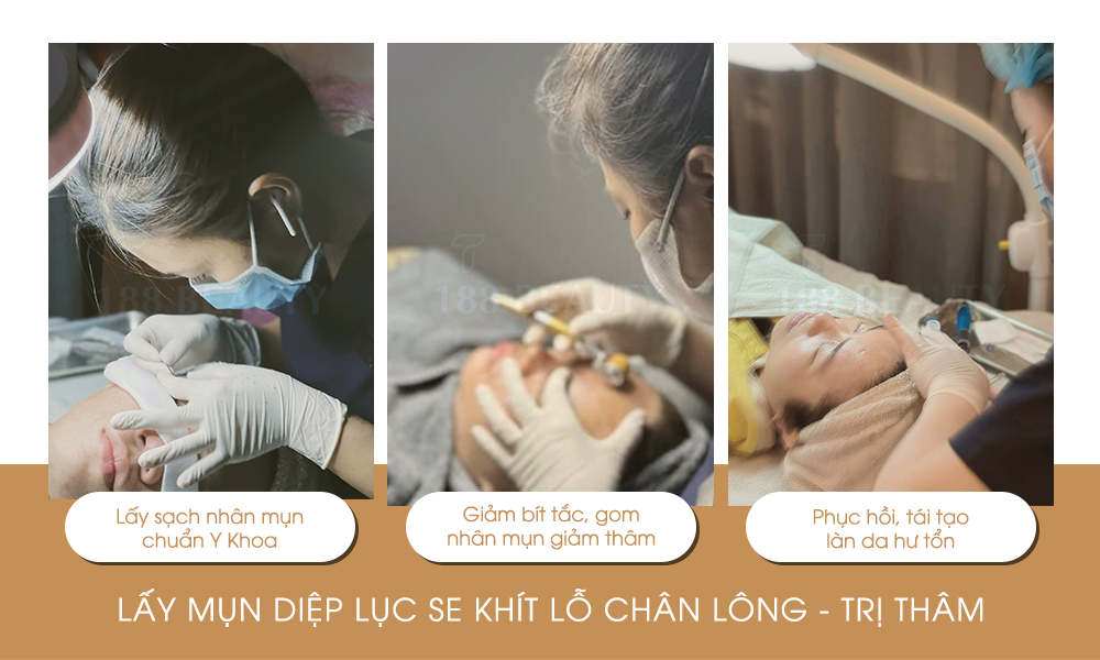 2-Lấy-mụn-diệp-lục