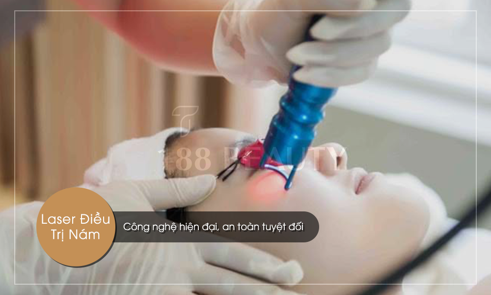 4-Laser-trị-nám