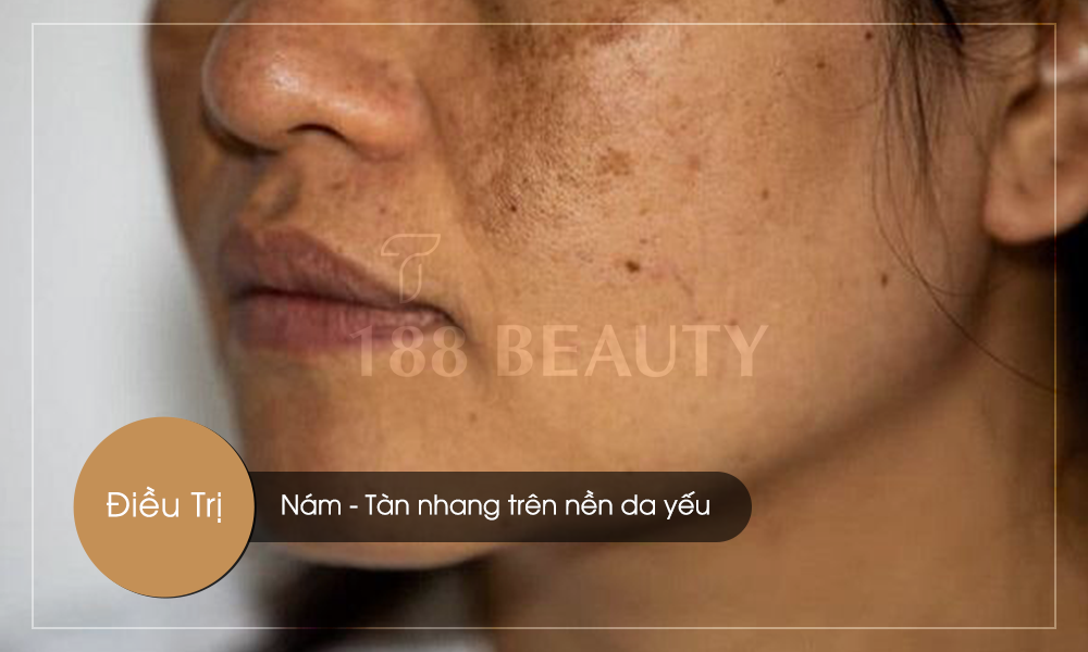 Nám-tàn-nhang-da-yếu