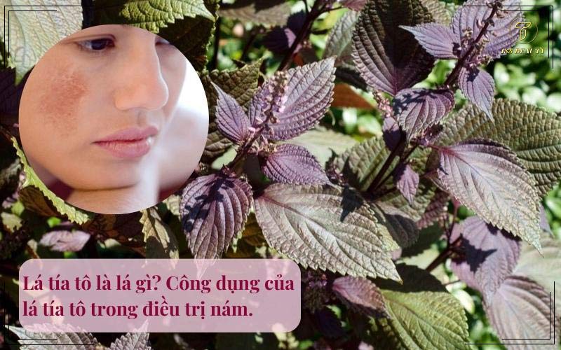 Cách trị nám bằng lá tía tô tại nhà