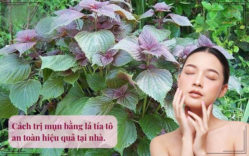 Cách trị mụn bằng lá tía tô hiệu quả tại nhà
