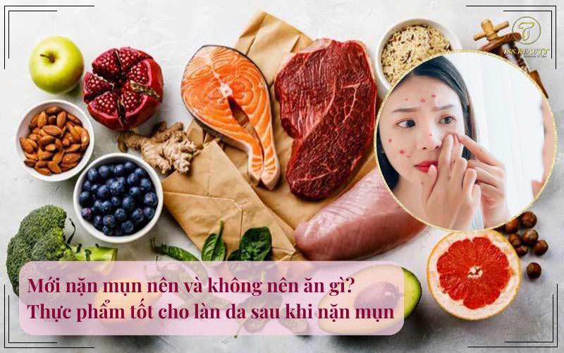 Nặn mụn không nên ăn gì