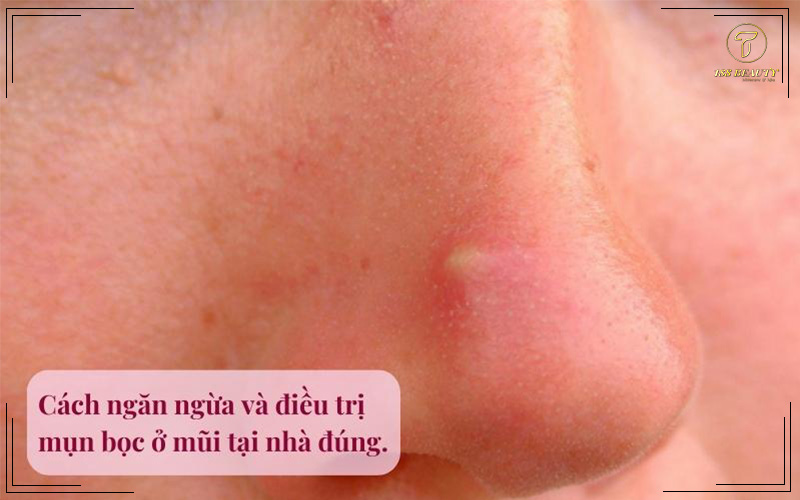Mụn bọc ở mũi